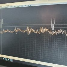 Определяем стучащую форсунку с помощью осциллографа Постоловского и микрофона