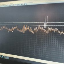 Определяем стучащую форсунку с помощью осциллографа Постоловского и микрофона