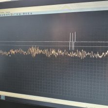 Определяем стучащую форсунку с помощью осциллографа Постоловского и микрофона