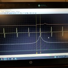 Осциллограмма давления впрыска датчика давления в камере сгорания и датчика коленвала