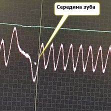 Середина зуба на осциллограмме