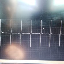 Осциллограмма на исправном датчике коленвала